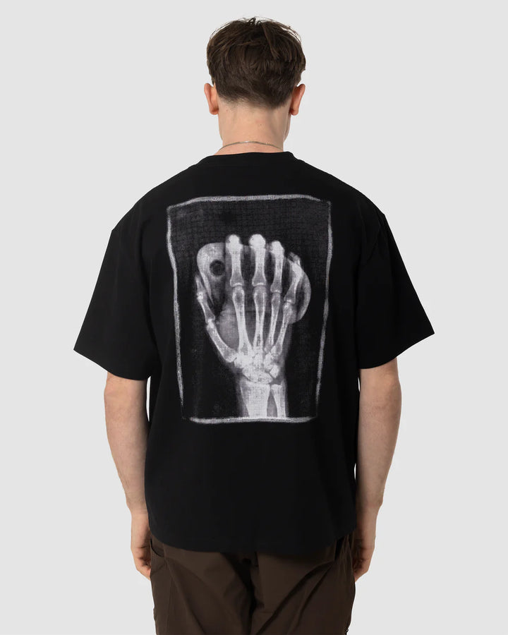 X-Ray Tee